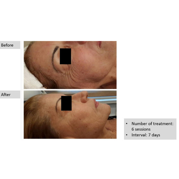 Genosys Eyecell Kit
